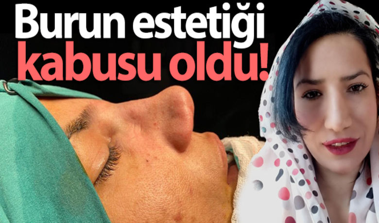 Samsun Bafra Burun Estetigi